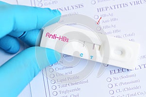 Detection of Ã Â¹â°hepatitis B antibody by using rapid test cassette photo
